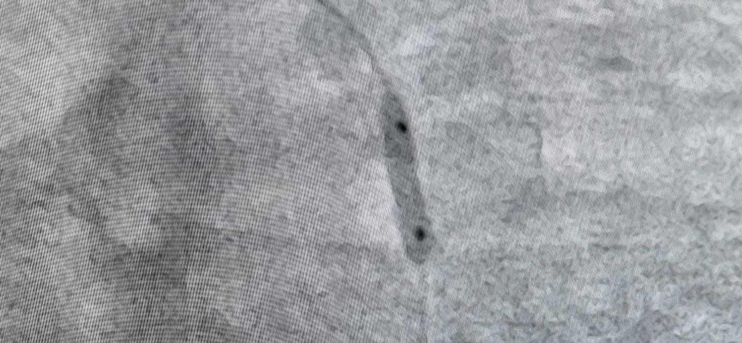 Cardiac catheterization fluoroscopy